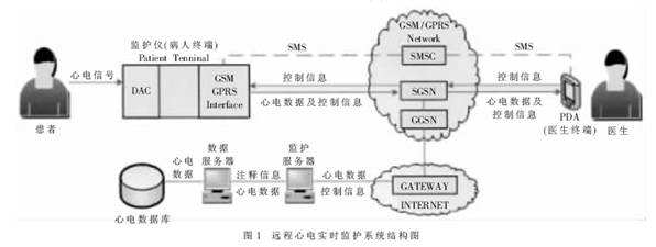 心电监护.jpg